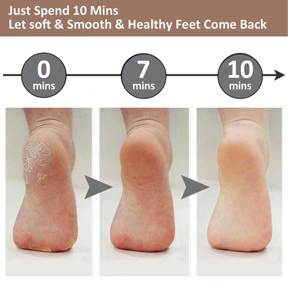 Electric Foot Callus Remover – Smooth & Soft Feet