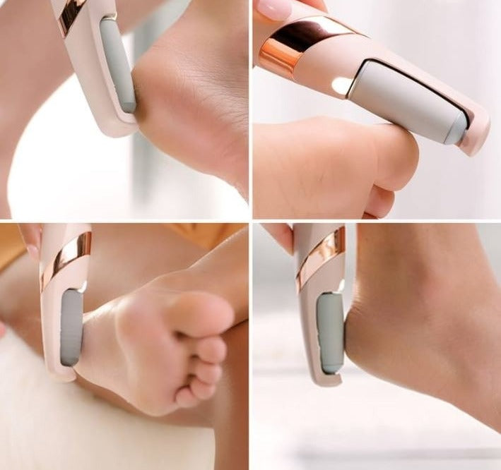 Electric Foot Callus Remover – Smooth & Soft Feet